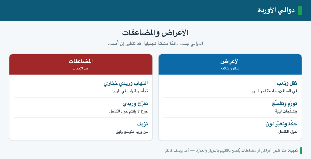 أعراض دوالي الساقين