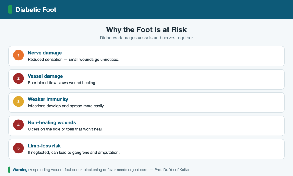 Diabetic foot: vessel and nerve damage