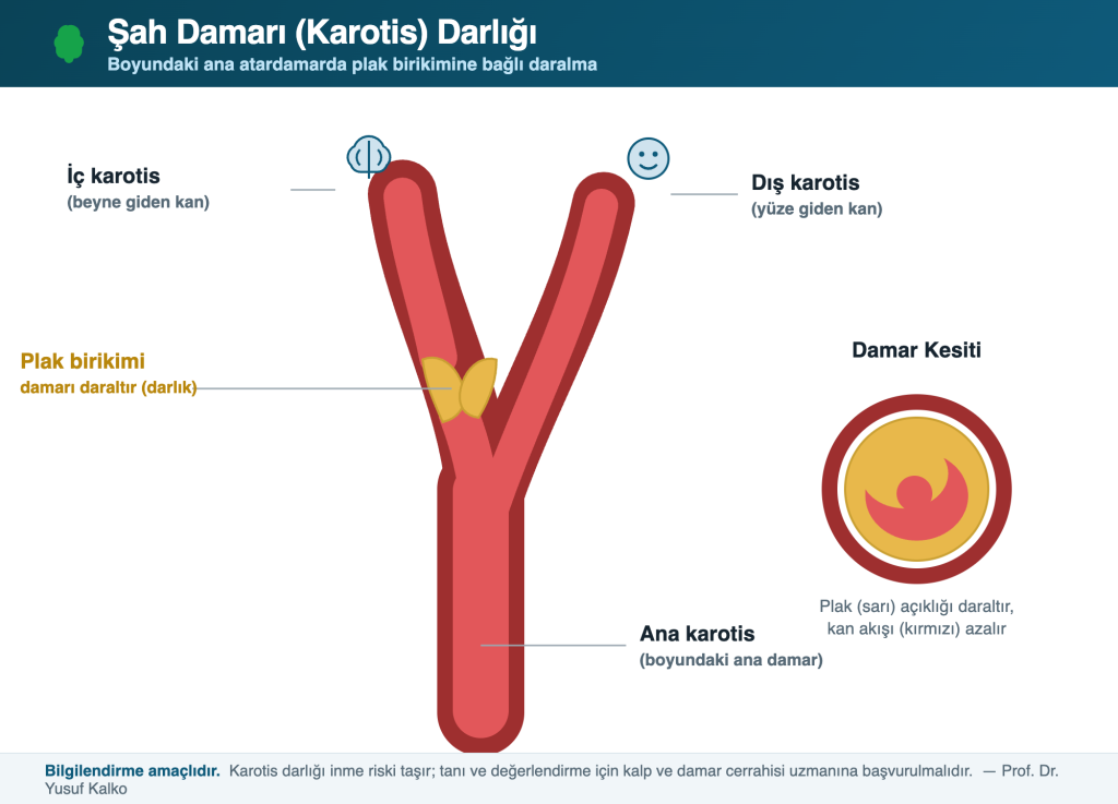 Check-up’ta Şah Damarı Ultrasonu