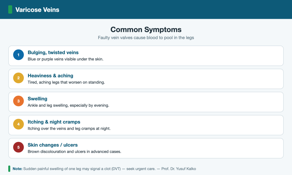 Varicose veins common symptoms