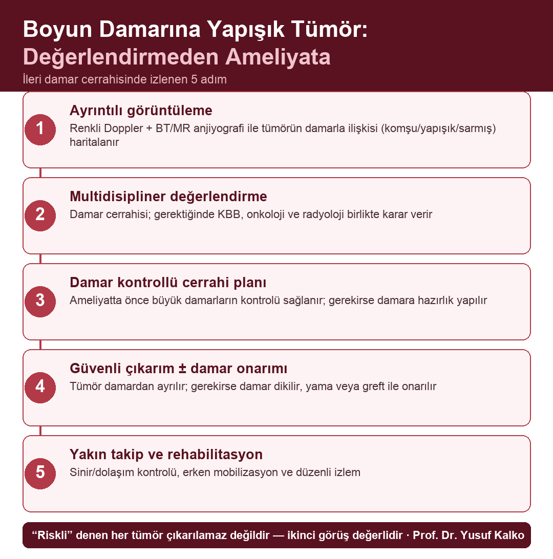 Boyun damarına yapışık tümörde değerlendirmeden ameliyata 5 adım: görüntüleme, multidisipliner karar, damar kontrolü, güvenli çıkarım ve onarım, takip