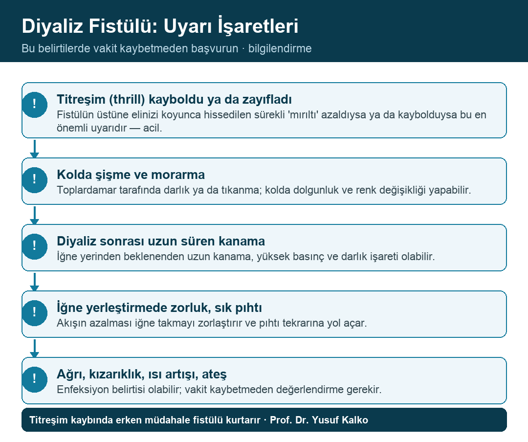 Diyaliz fistülü uyarı işaretleri infografiği
