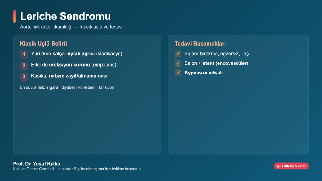 Leriche sendromu: klasik üçlü belirti, risk faktörleri ve tedavi infografiği