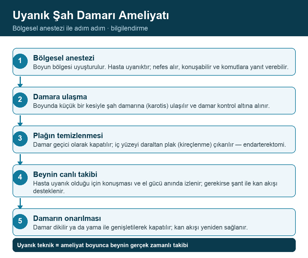 Uyanık şah damarı ameliyatı adımları infografiği