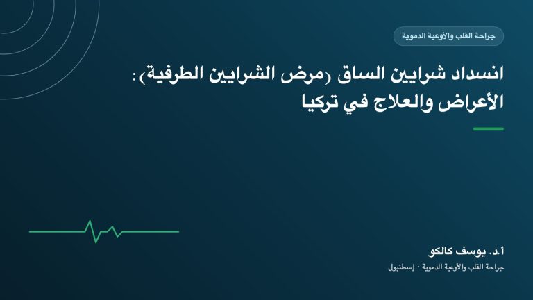 انسداد شرايين الساق (مرض الشرايين الطرفية): الأعراض والعلاج في تركيا