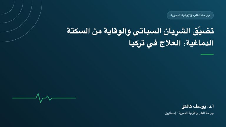 تضيّق الشريان السباتي والوقاية من السكتة الدماغية: العلاج في تركيا