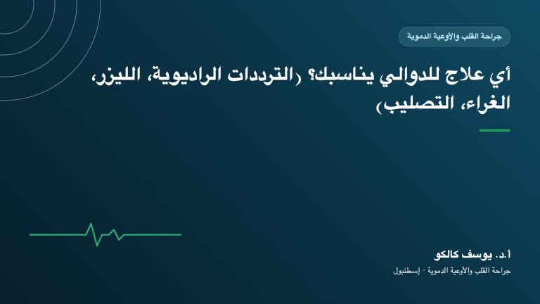 أي علاج للدوالي يناسبك؟ (الترددات الراديوية، الليزر، الغراء، التصليب)