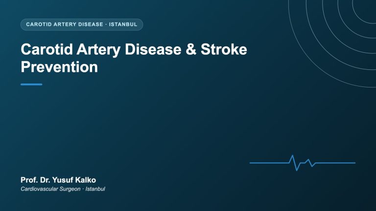 Carotid Artery Disease and Stroke Prevention