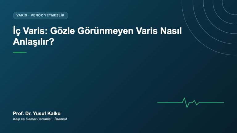 İç Varis Nedir?