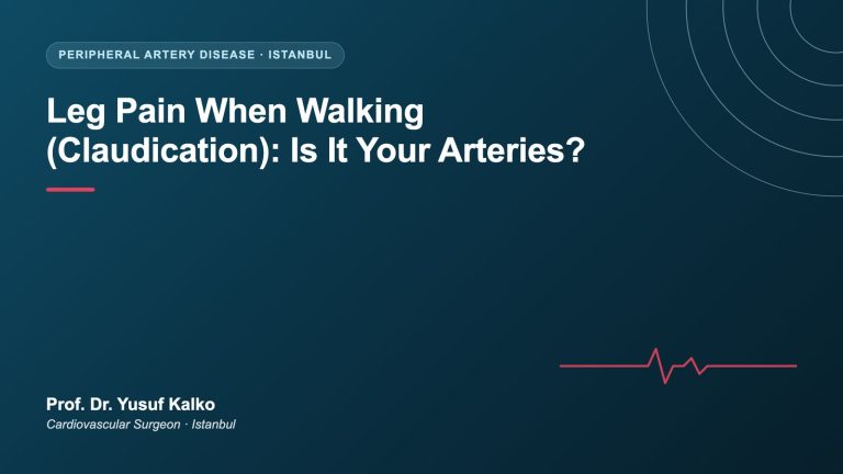 Leg Pain When Walking (Claudication)