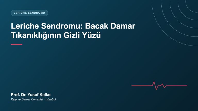 Leriche Sendromu: Belirtileri, Klasik Üçlüsü ve Tedavisi