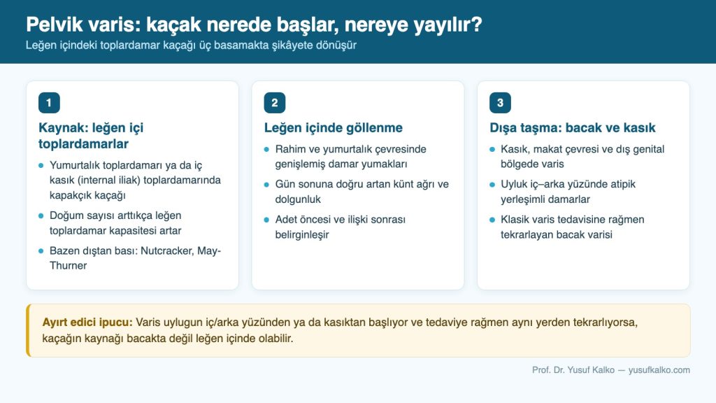 Pelvik variste kaçağın kaynağı, leğen içindeki göllenme ve bacağa yayılım yolları