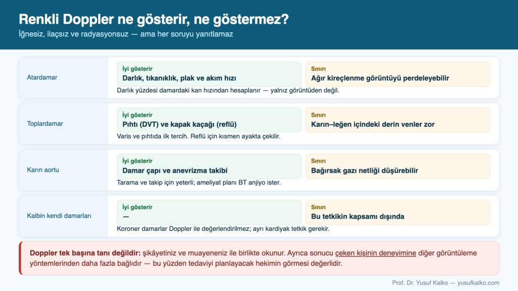 Renkli Doppler ne gösterir, ne göstermez?